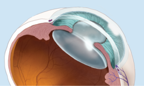 Layers of the eye graphic
