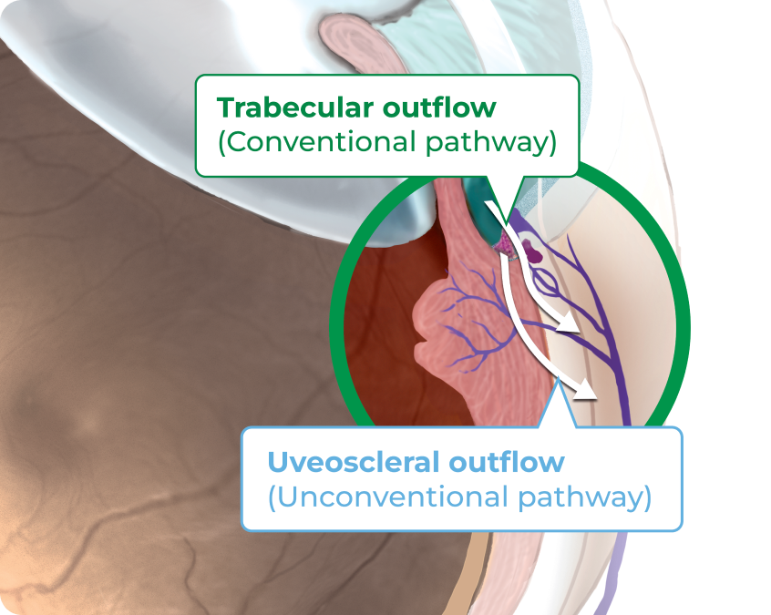Trabecular outflow and Uveoscleral outflow graphic